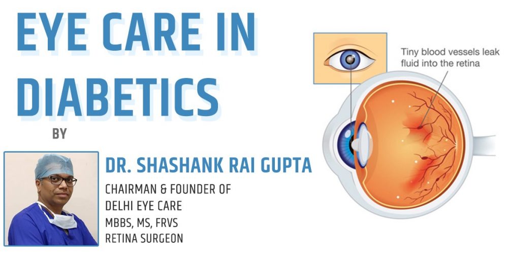retina surgeon in delhi india