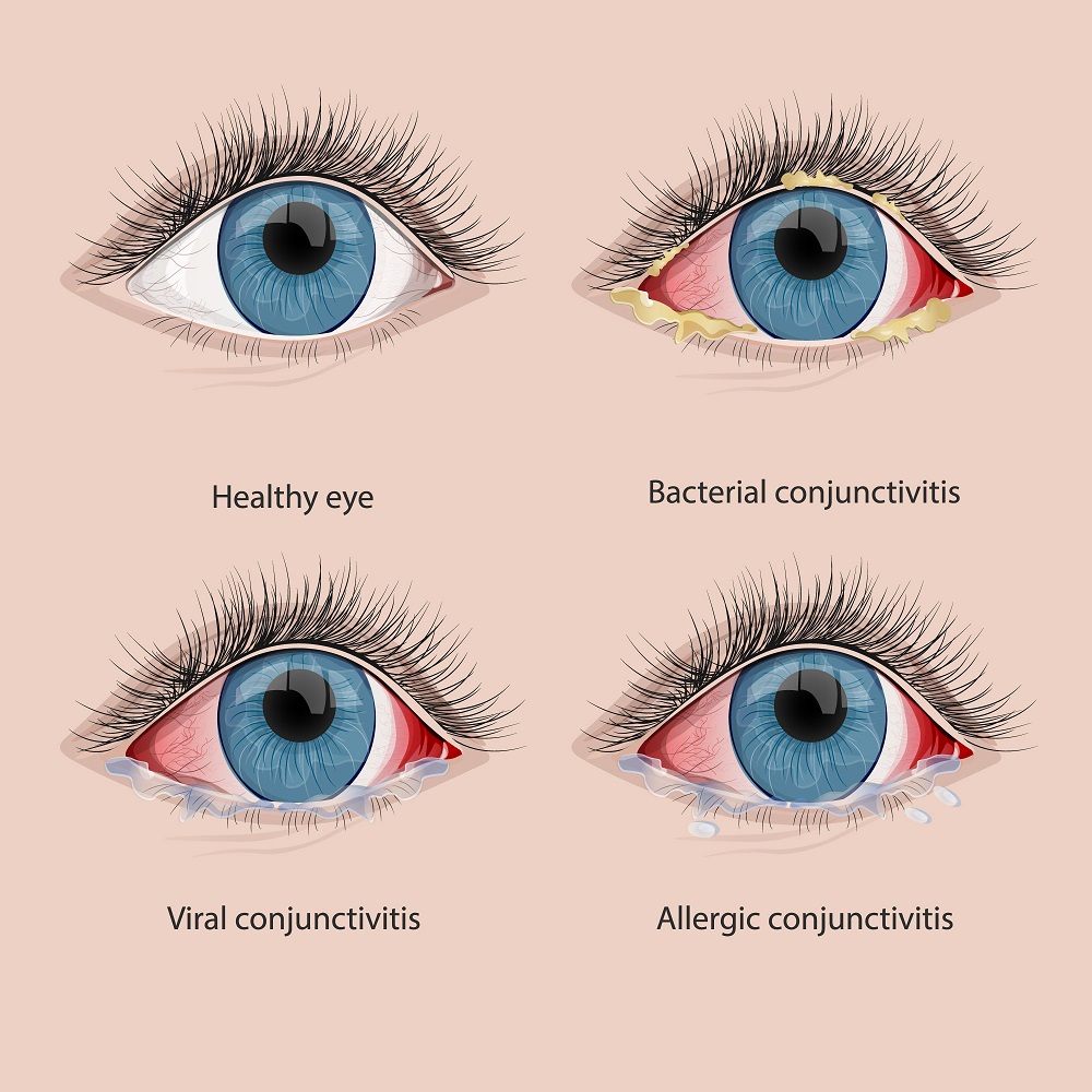 Your Diet for Healthy Eyesight