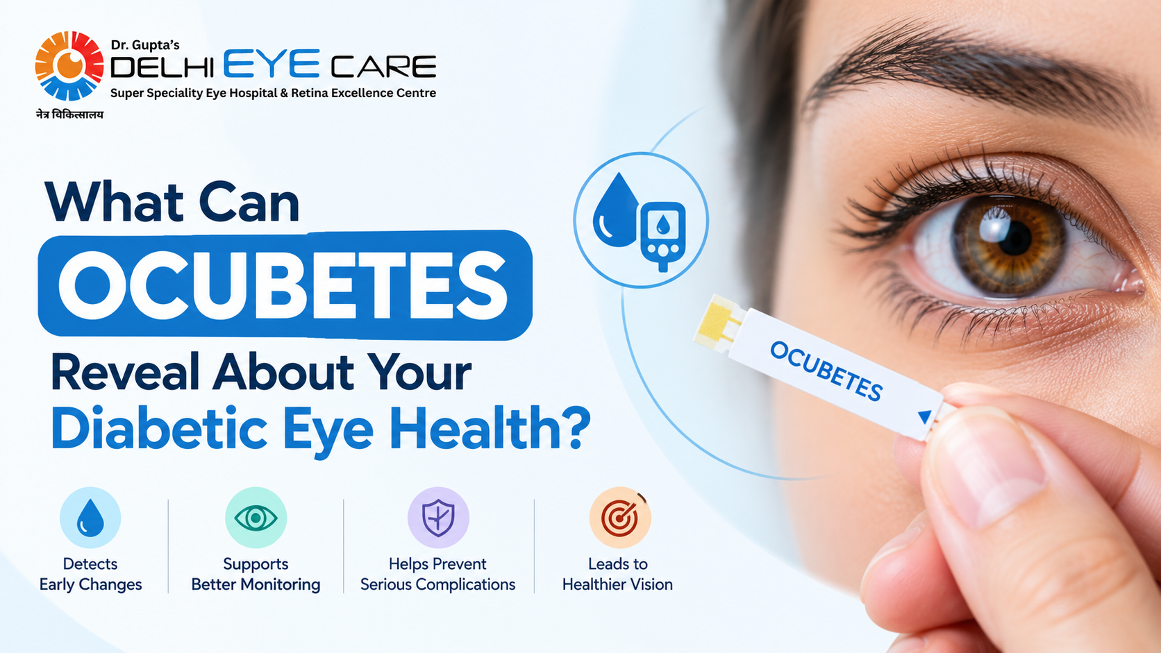 Best Ocubetes Treatment in Delhi