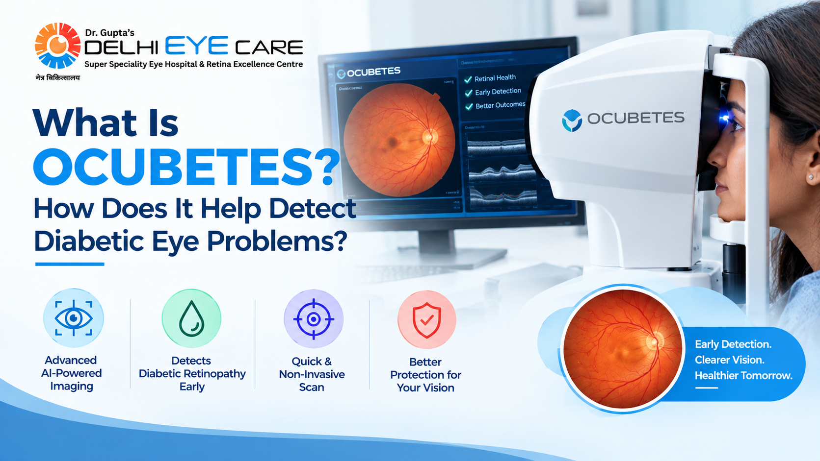 Best Ocubetes Treatment in Delhi